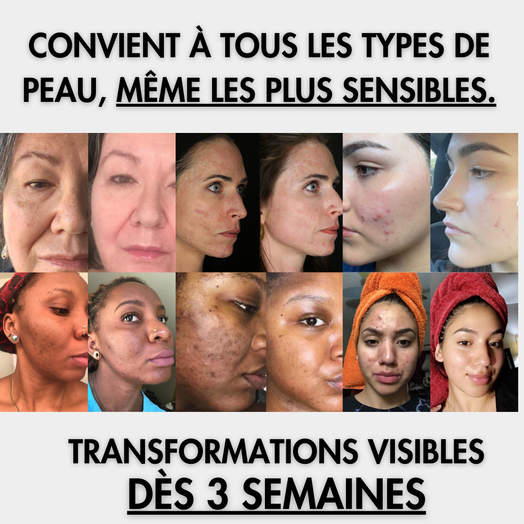 Curaskin – Pads éclat visage au curcuma & acide kojique (40 unités)