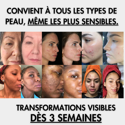 Curaskin – Pads éclat visage au curcuma & acide kojique (40 unités)